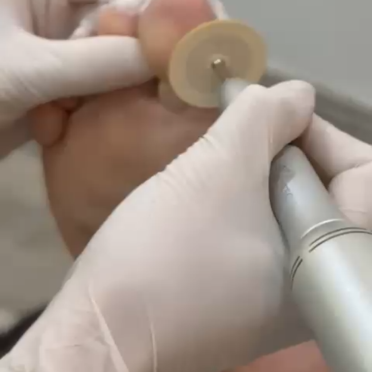 frame-alta-resolucao